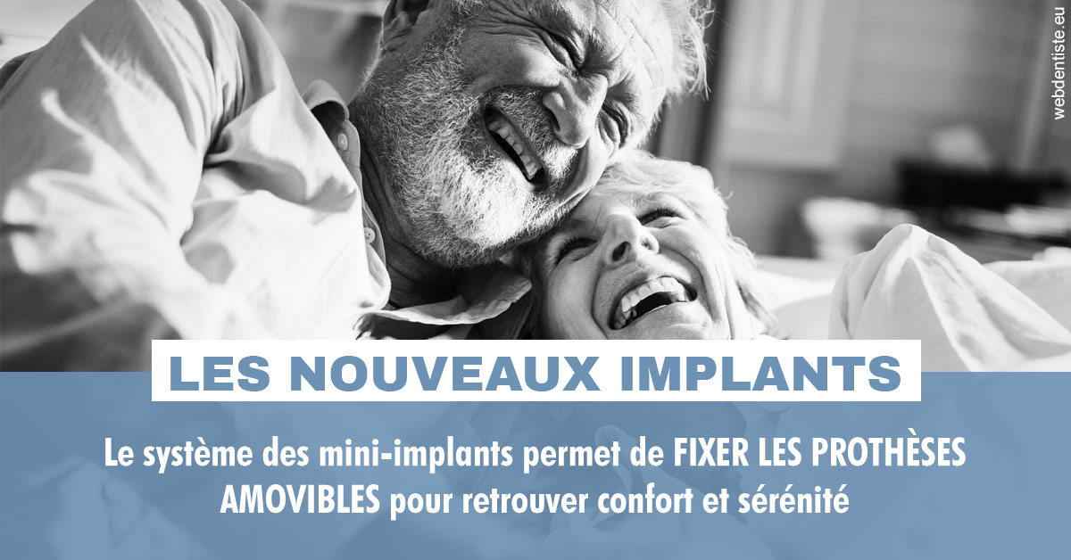 https://www.cabinetdentaire-etoile.fr/Les nouveaux implants 2
