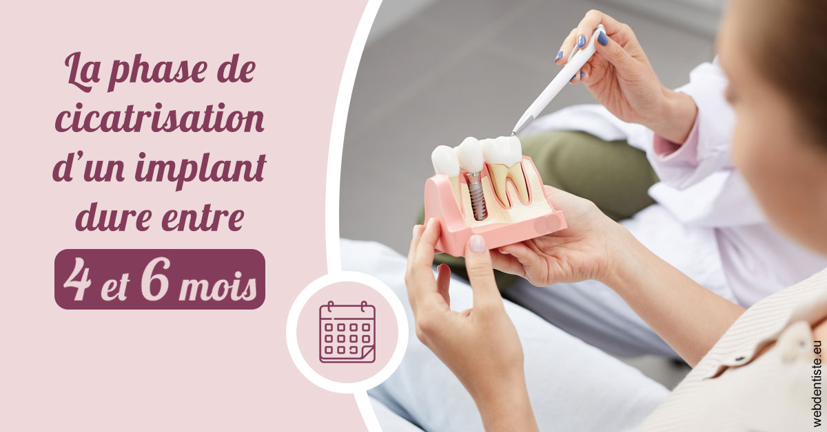 https://www.cabinetdentaire-etoile.fr/Cicatrisation implant 2