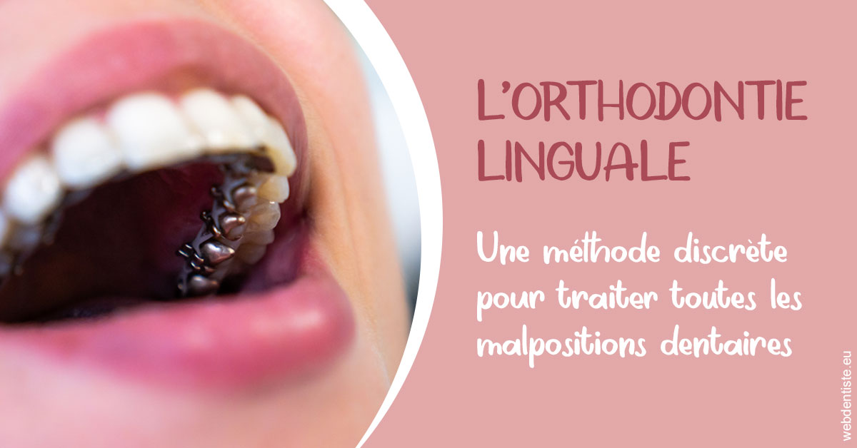 https://www.cabinetdentaire-etoile.fr/L'orthodontie linguale 2