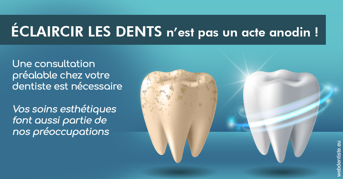 https://www.cabinetdentaire-etoile.fr/Eclaircir les dents 2