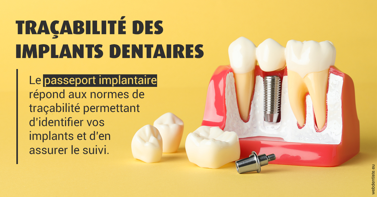 https://www.cabinetdentaire-etoile.fr/T2 2023 - Traçabilité des implants 2