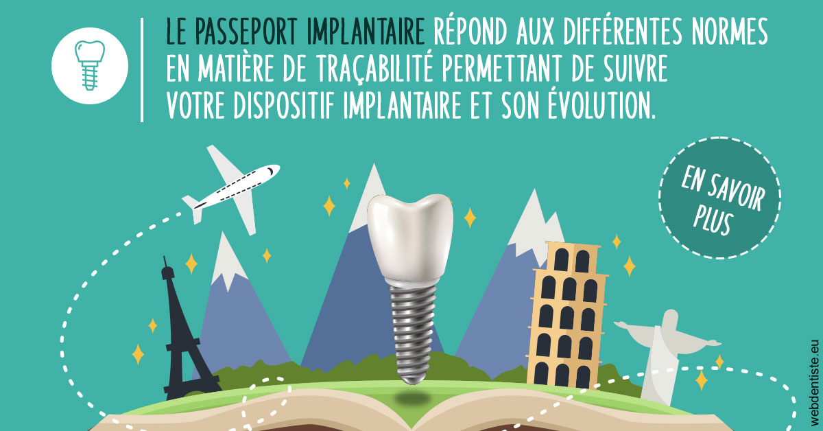 https://www.cabinetdentaire-etoile.fr/Le passeport implantaire