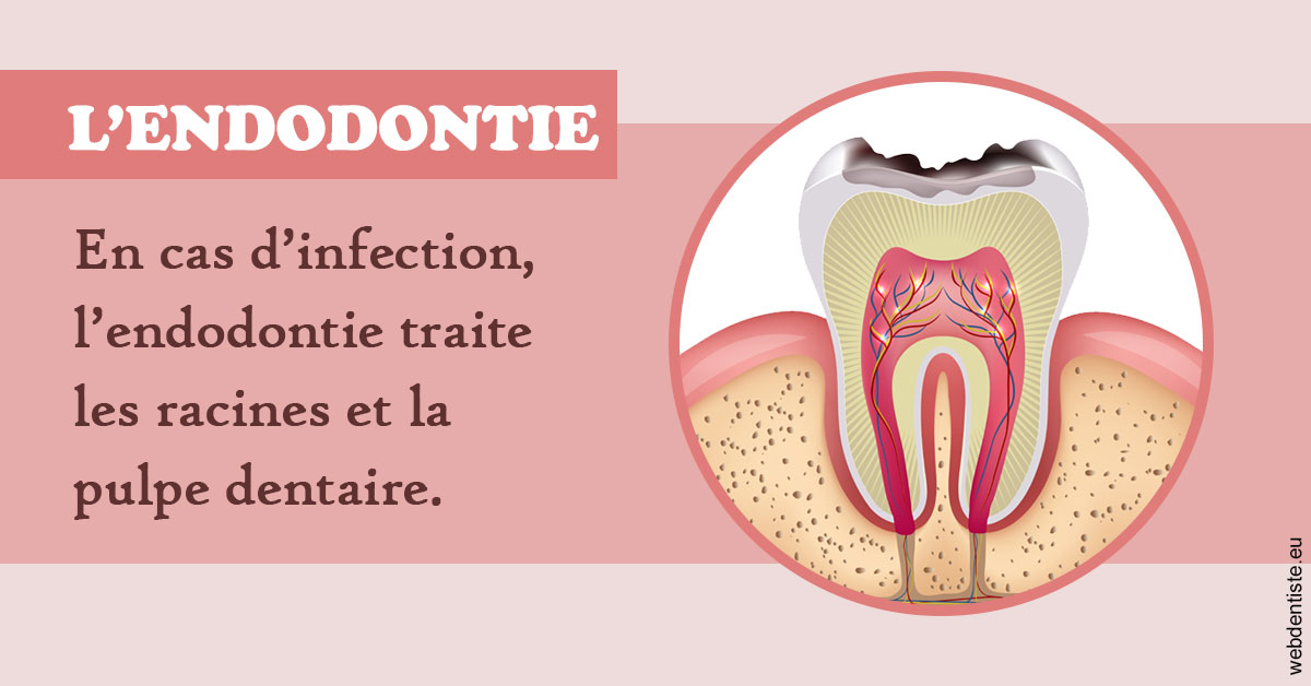 https://www.cabinetdentaire-etoile.fr/L'endodontie 2
