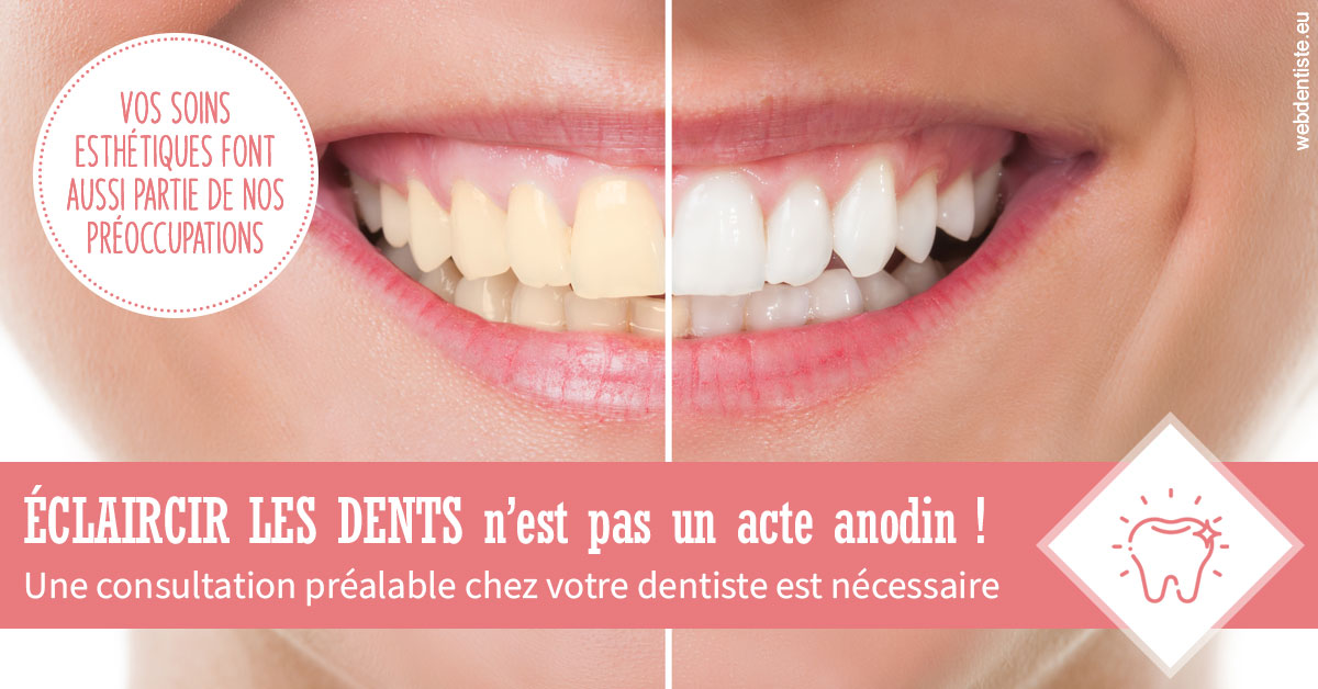 https://www.cabinetdentaire-etoile.fr/Eclaircir les dents 1