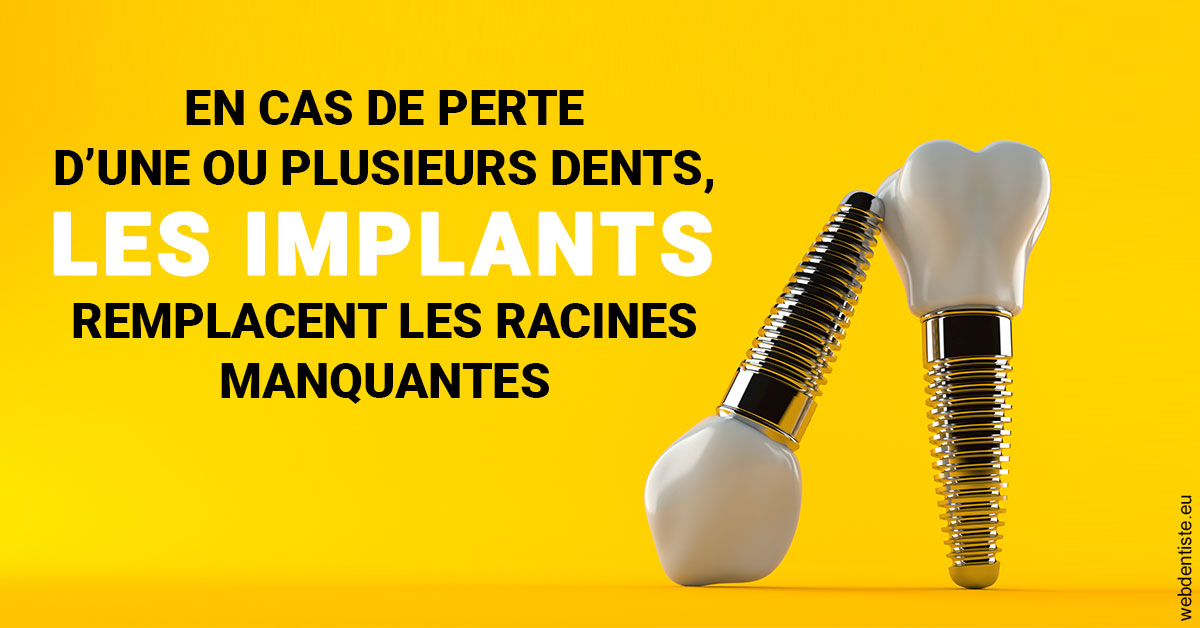 https://www.cabinetdentaire-etoile.fr/Les implants 2